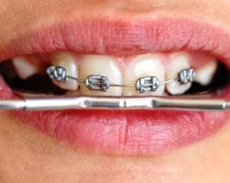 Prise de rendez-vous Orthodontiste Coppola